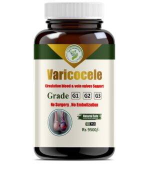 Varicocele Grade 1,2,3 Cap